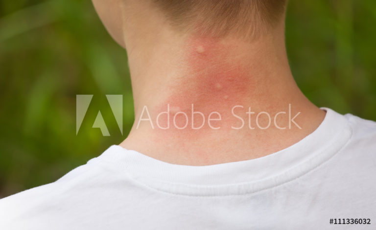 AdobeStock_111336032_Preview