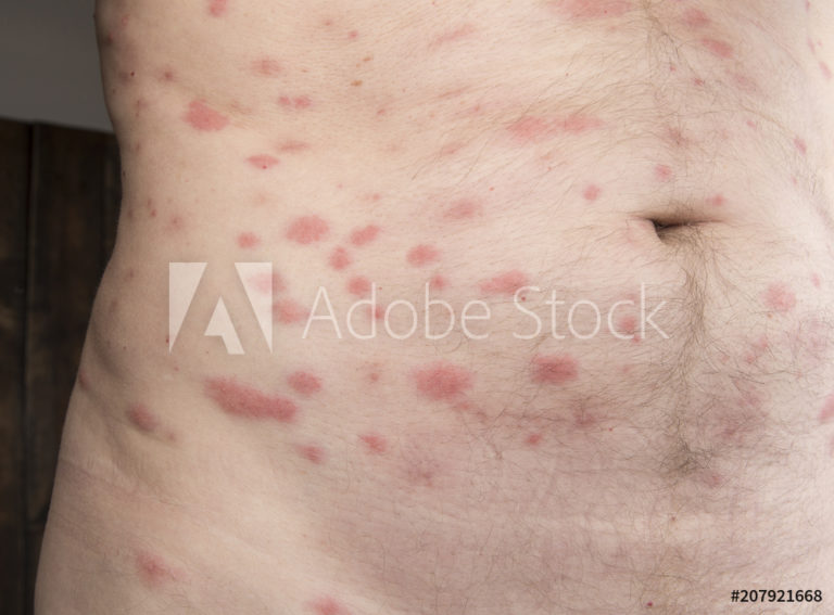 AdobeStock_207921668_Preview