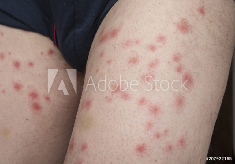 AdobeStock_207922165_Preview