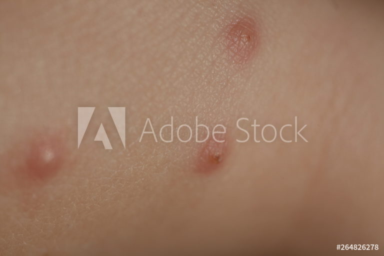 AdobeStock_264826278_Preview